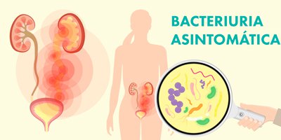 bacteriuria-asintomatica-mobile.jpg