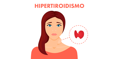 hipertiroidismo-mobile.png