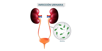 infeccion-urinaria-mobile.png