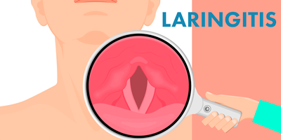 laringitis-mobile.png