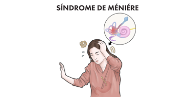 sindrome-meniere-mobile.png
