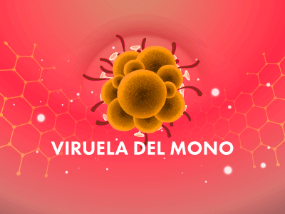 viruela-del-mono-articulo.png